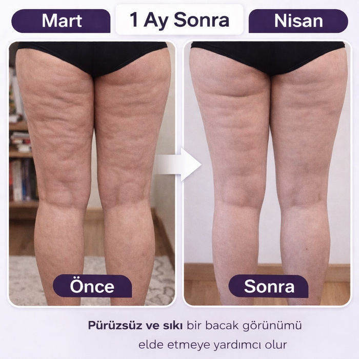 Önce