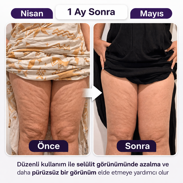 Sonra